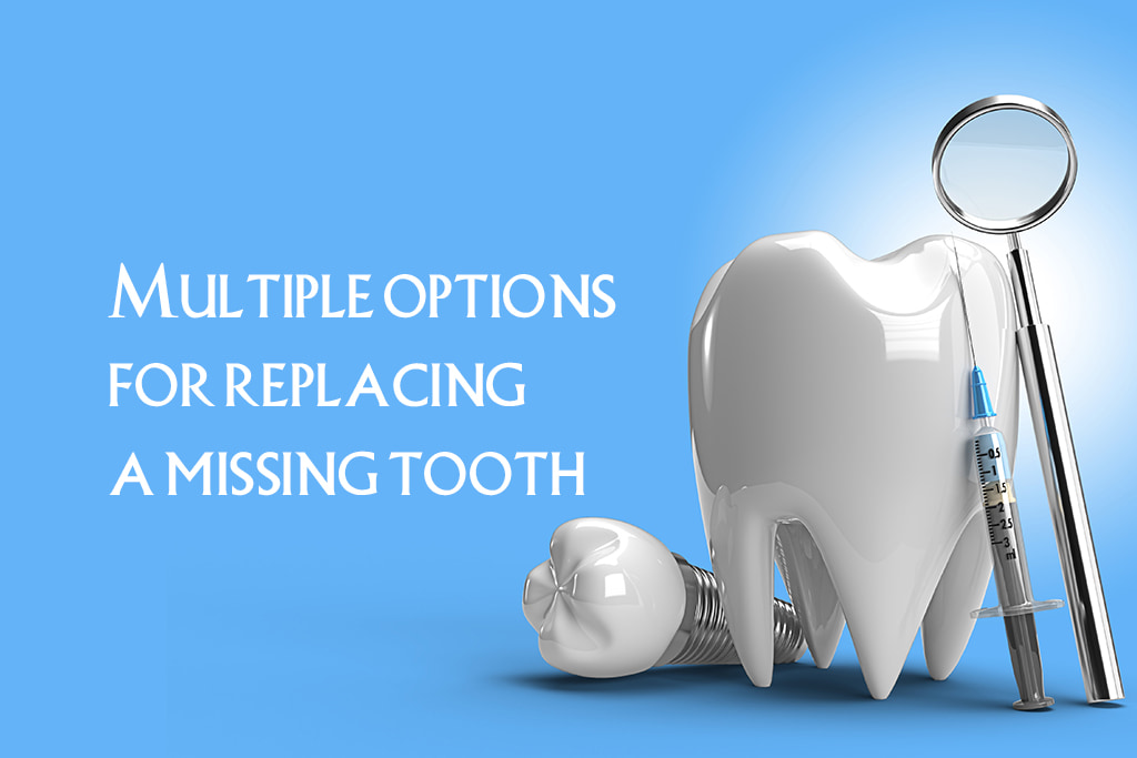 Options for replacing a missing tooth