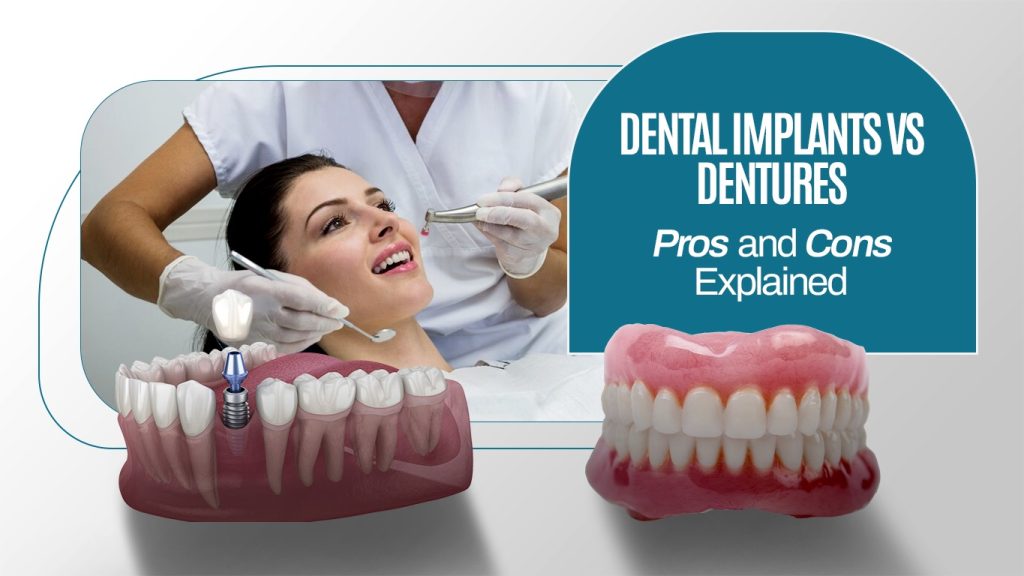 Comparison of dental implants and dentures with a patient exam.