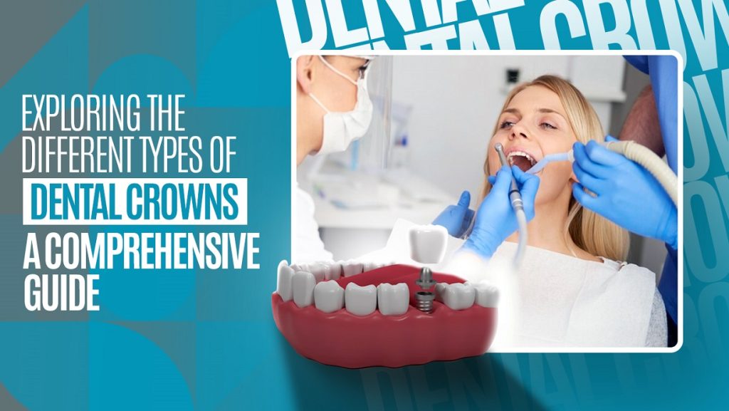 Dental crowns guide the dentist and patient during treatment