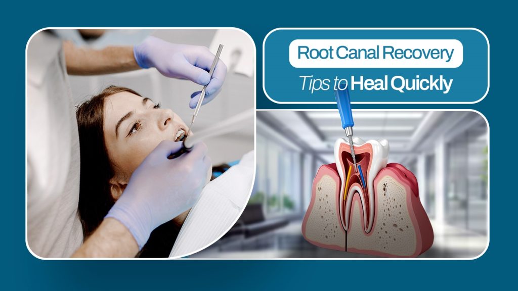 Root canal recovery tips with dental procedure