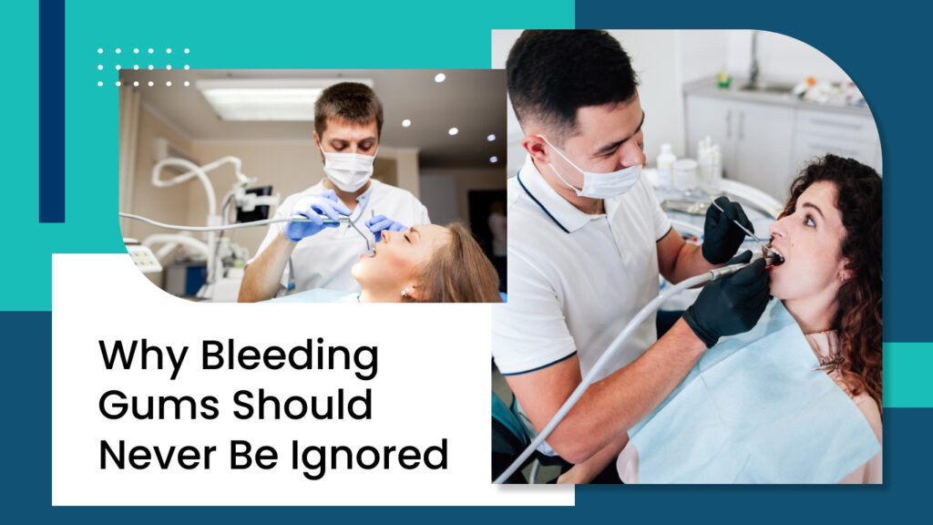 Dentists treating patients with bleeding gum concerns